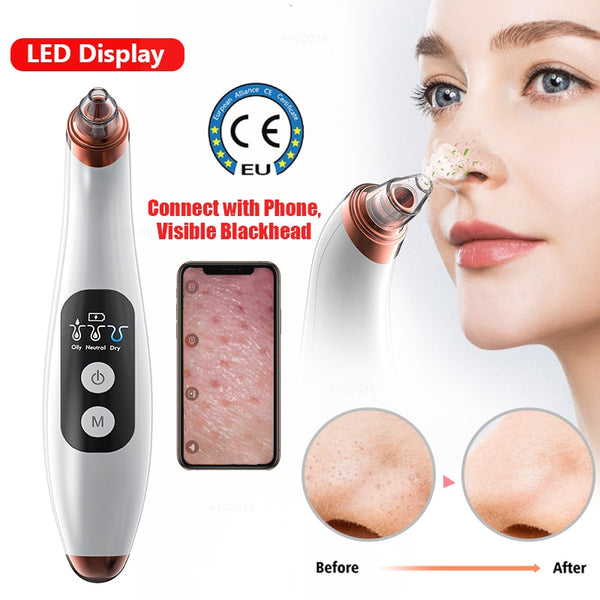 Visual Blackhead Remover Facial Cleaner Nose Deep Pore Remover Acne Pimple Removal Vacuum Suction